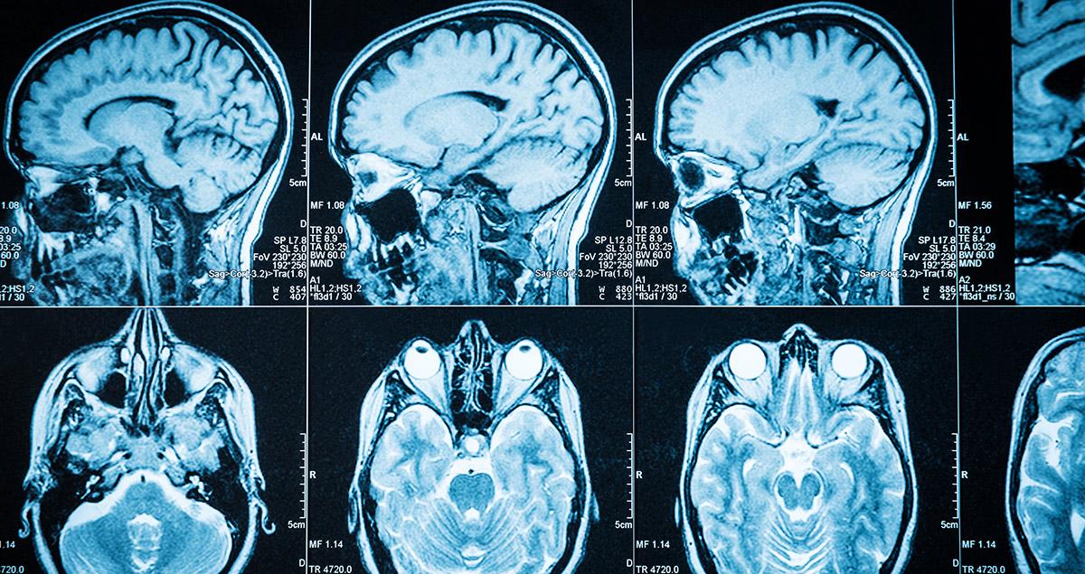 MHI0031803A03---FT-50-Ideas-Brain-implants-allow-paralysed-patients-to-move-limbs-nobar.jpg